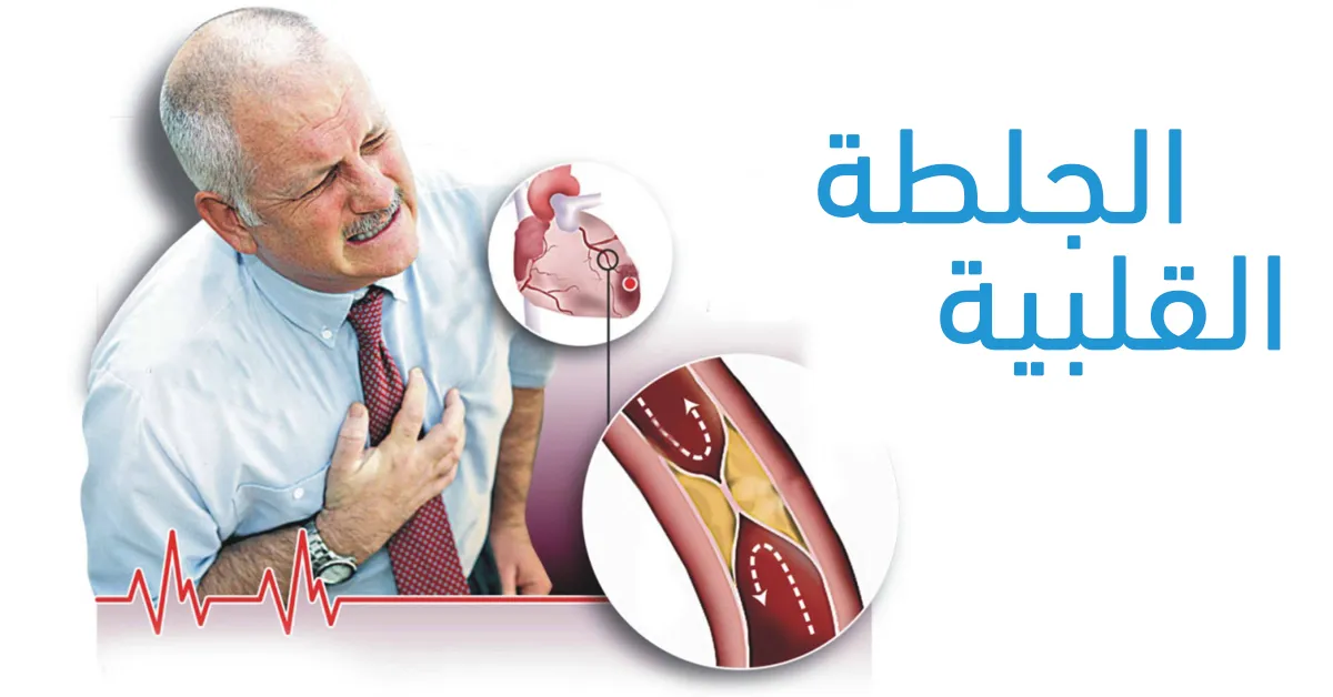 الجلطة القلبية